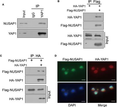 NUSAP1 Promotes Gastric Cancer Tumorigenesis and Progression by Stabilizing the YAP1 Protein